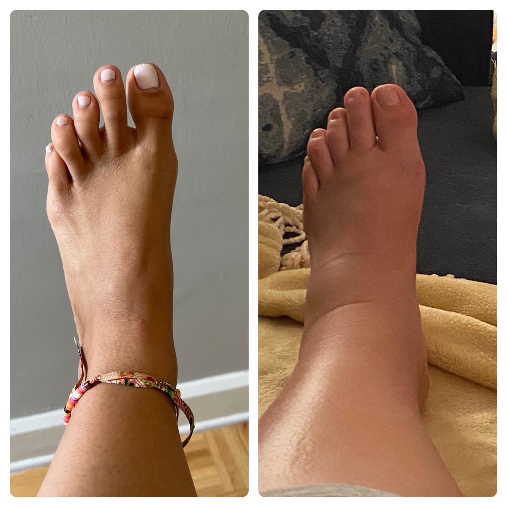 ThermoFlex